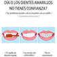 🦷✨ Limpiador Dental Ultrasónico 5 en 1 – 3 Velocidades Ajustables para Limpieza Profunda y Suave 💦📦