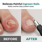 ✂️Set profesional de cortauñas 3 en 1 para pedicura – Herramienta de precisión de acero inoxidable para uñas ✨